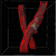 Asnapshot of a multi-image Z stack that was acquired with the Z1 lightsheet 