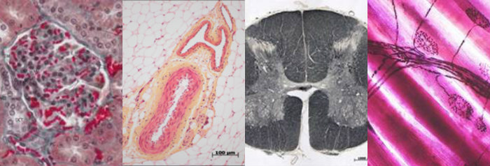 Images of type of histology