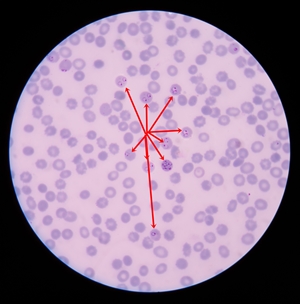 malaria 450b