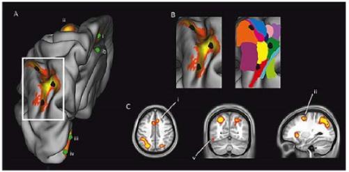 black background with medical illustrations, scans and digital simulation of neurological systems. Read caption below for more description