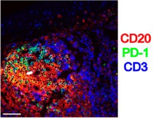 Digital image of multiplex IHC