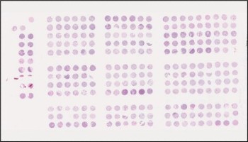 Sample of a Tissue Mircroarray