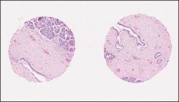 Sample of a Tissue Microarray 2