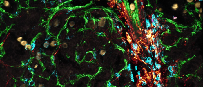  Ximena using live lung slices in KM mice