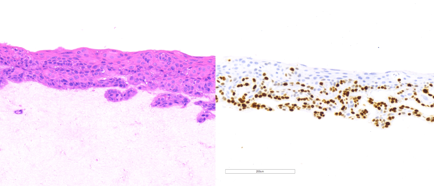 HaCaT cell line stained H&E and Ki67